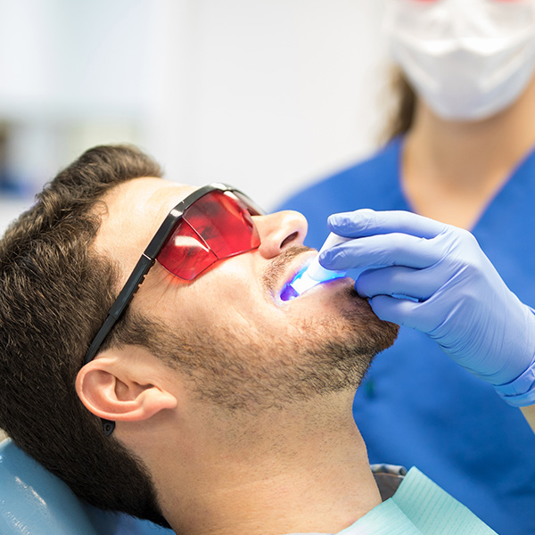 Estetica Dental - Blanqueamiento dental